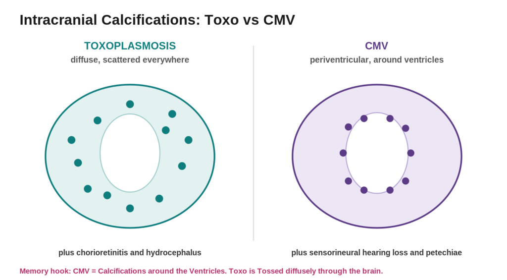 Diffuse versus periventricular intracranial calcifications
